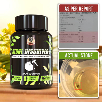 STONE DISSOLVER 🪨🔨 | Suplemento Renal para Cálculos e Infección